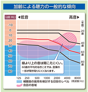 補聴器　加齢　聴力　一般的な傾向